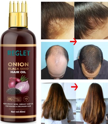 REGLET Onion Oil - Black Seed Onion Hair Oil - WITH COMB APPLICATOR - Controls Hair Fall - NO Mineral Oil, Silicones, Cooking Oil & Synthetic Fragrance Hair Oil  (60 ml)